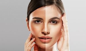 چگونه پوست سفید داشته باشیم؟(راهکارهای طلایی ساده)