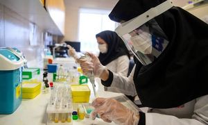 افتتاح خط تولید کیت تشخیص کرونا در  شرکت دانش بنیان ایرانی