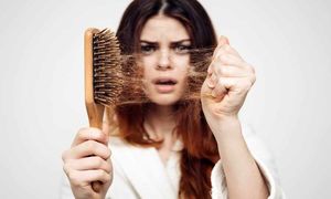 7 شامپو ضدریزش ارزان ایرانی + قیمت
