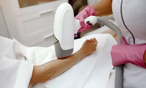 بهترین مرکز لیزر موهای زائد در اصفهان را بشناسید